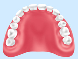 保険診療の入れ歯
