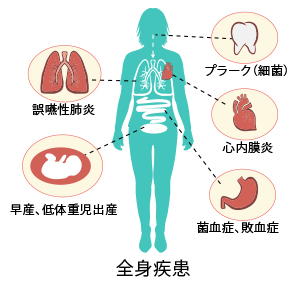 全身に影響をおよぼすこともあります